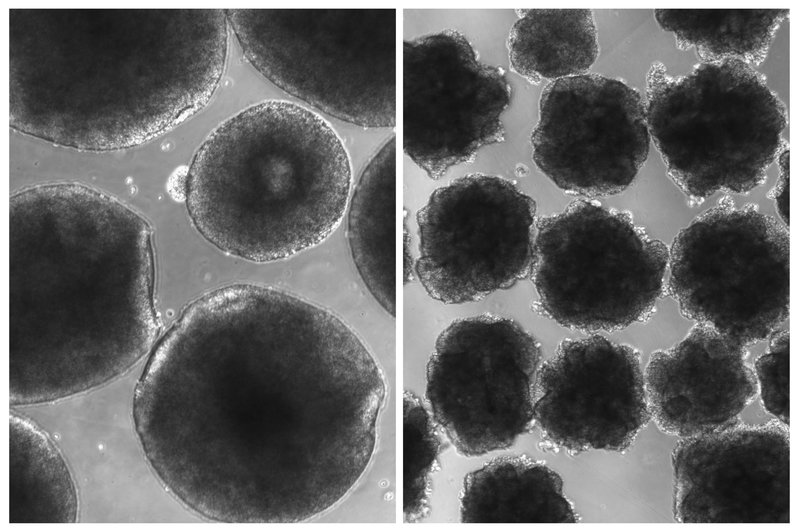 'Minibrains' or Human Cerebrum Organoids With Neanderthal Gene Can Tell Us About Human Evolution!!!